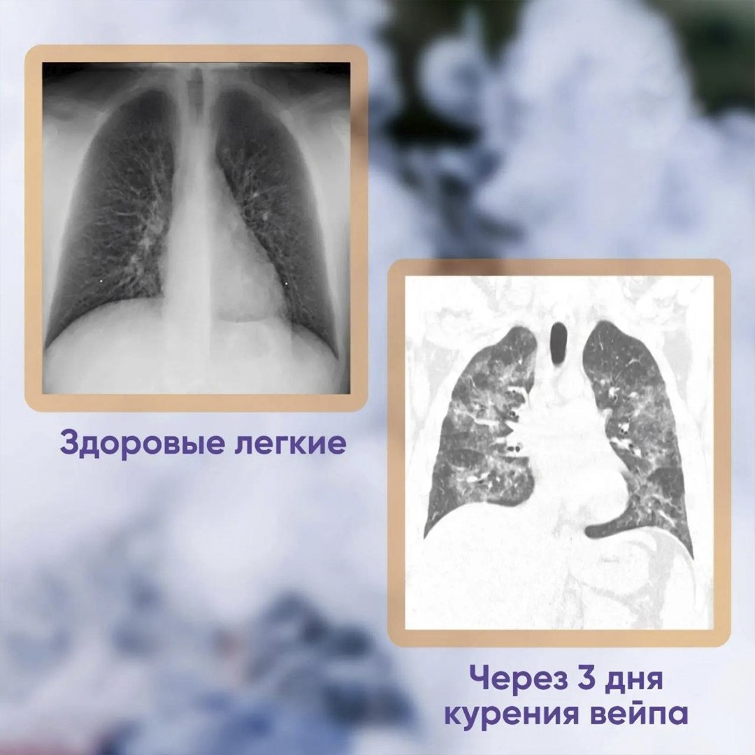 Молодой человек с одышкой из-за вейпинга