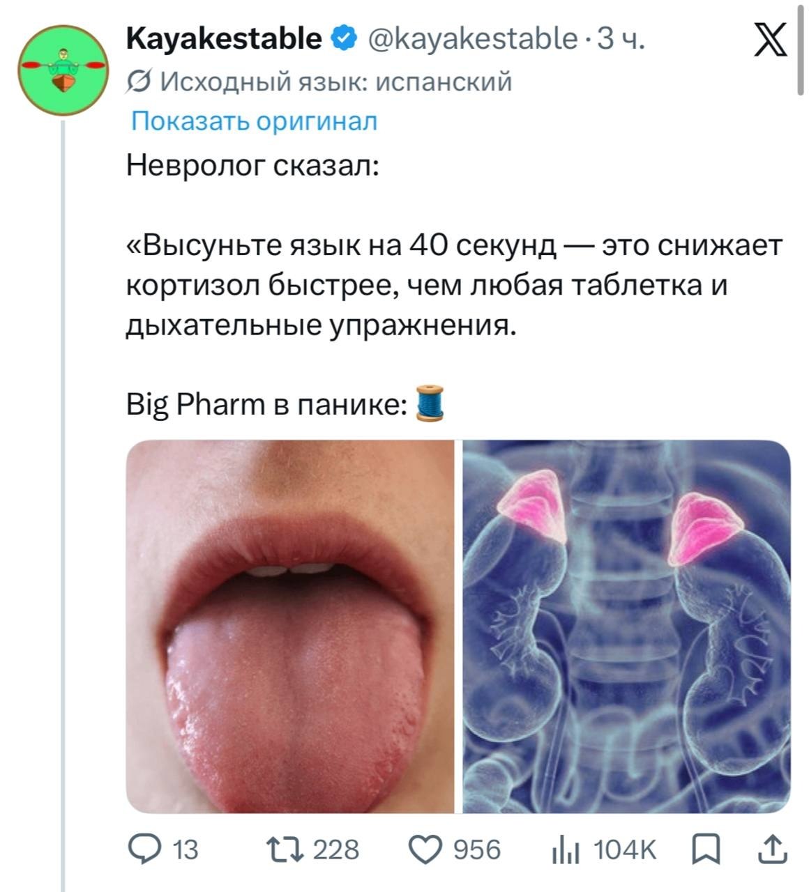 Человек выполняет упражнение с высунутым языком для снижения кортизола